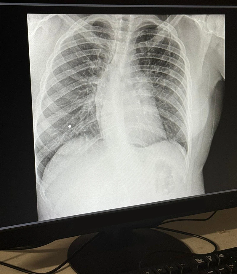 Jayla Xray Jayla Xray