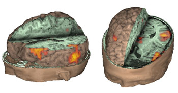 3D_Ort1.jpg