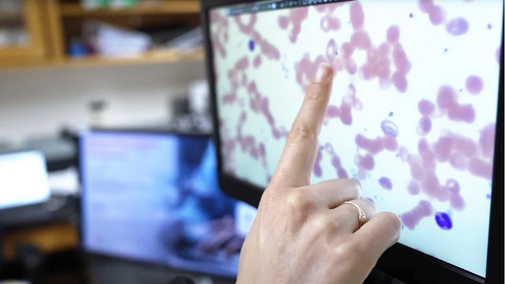 Finger pointing to microscopic image on a computer screen.