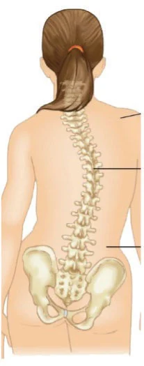 columna-vertebral-escoliosis.jpg columna-vertebral-escoliosis.jpg