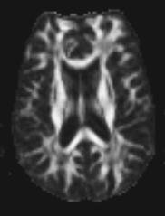 Fractional_Anisotropy.jpg
