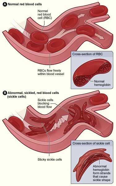 scd_cell-comparison.jpg