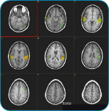 fmri1.png
