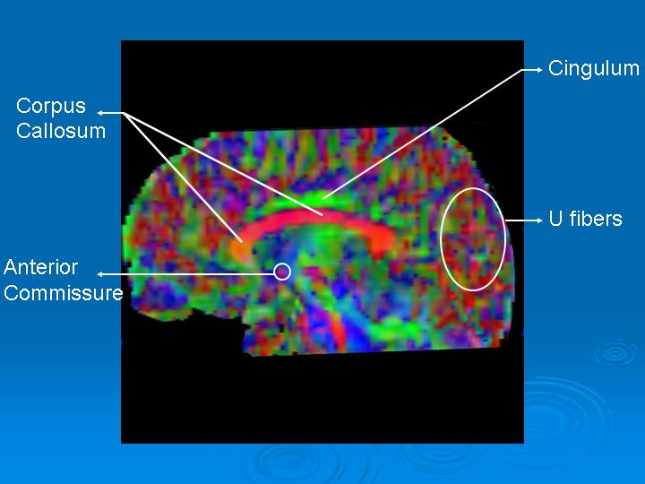 FA_map_sagittal.jpg