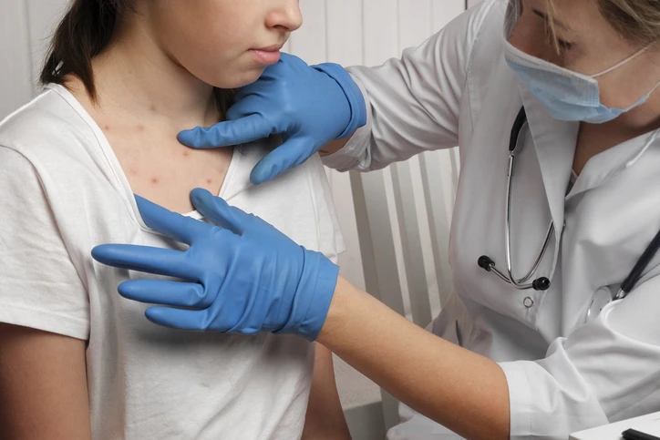 Médico examinando a una paciente de sexo femenino para detectar sarampión.